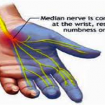 Median Nerve