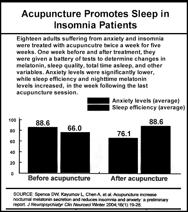 Acupuncture for Insomnia, Can Acupuncture Help Your Insomnia 