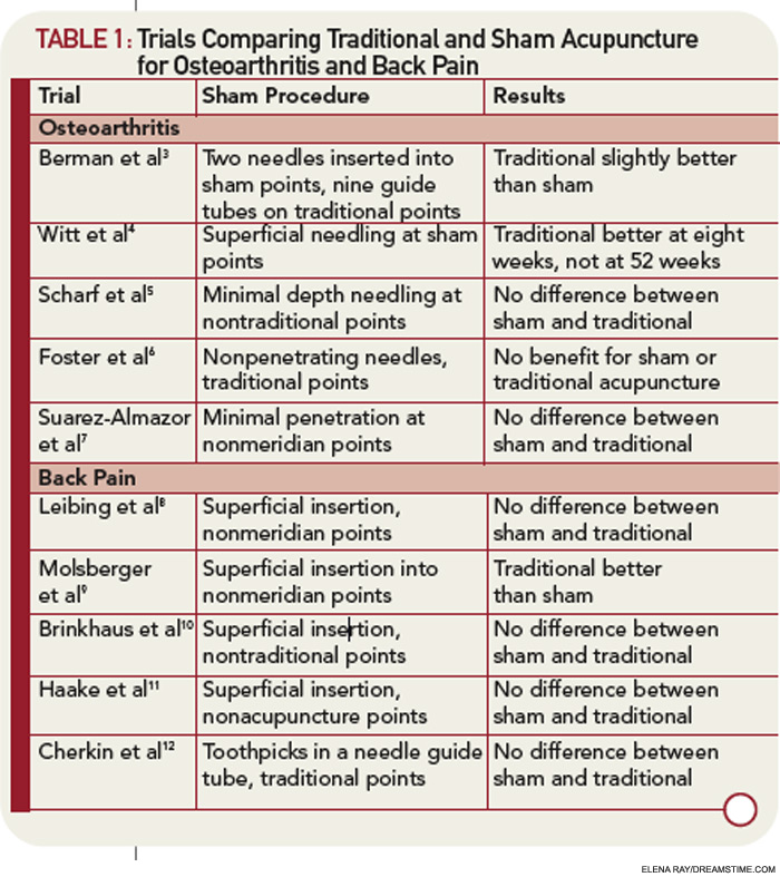 Acupuncture for Back Pain, Can Acupuncture Help with Back Pain