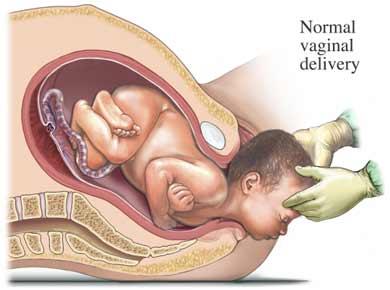 Vaginal Birth