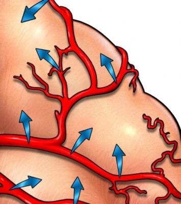 Blood Vessel in Brain