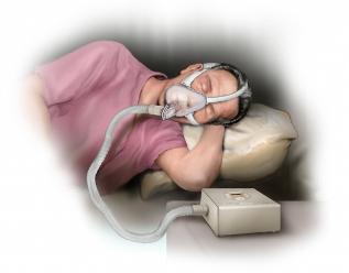 Continuous Positive Airway Pressure Machine