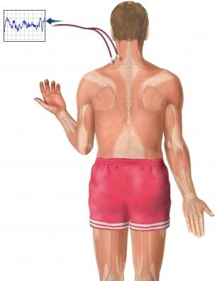 EMG of the Shoulder