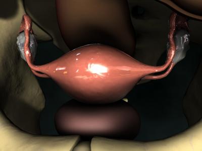 Laparoscopic View of Uterus