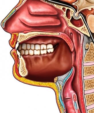 Mouth Cavity After Total Glossectomy