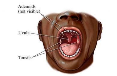 The Tonsils