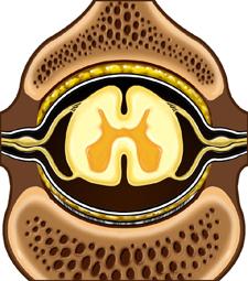 Cross-section of Vertebral Canal with Spinal Cord in the Center