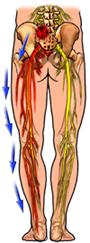 Sciatic Nerve Pain