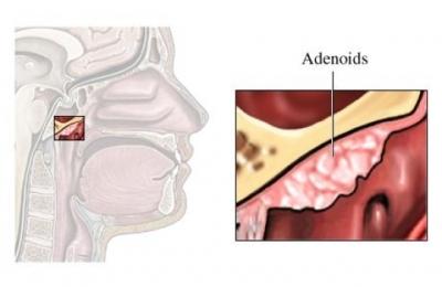 Anatomy of the Adenoids